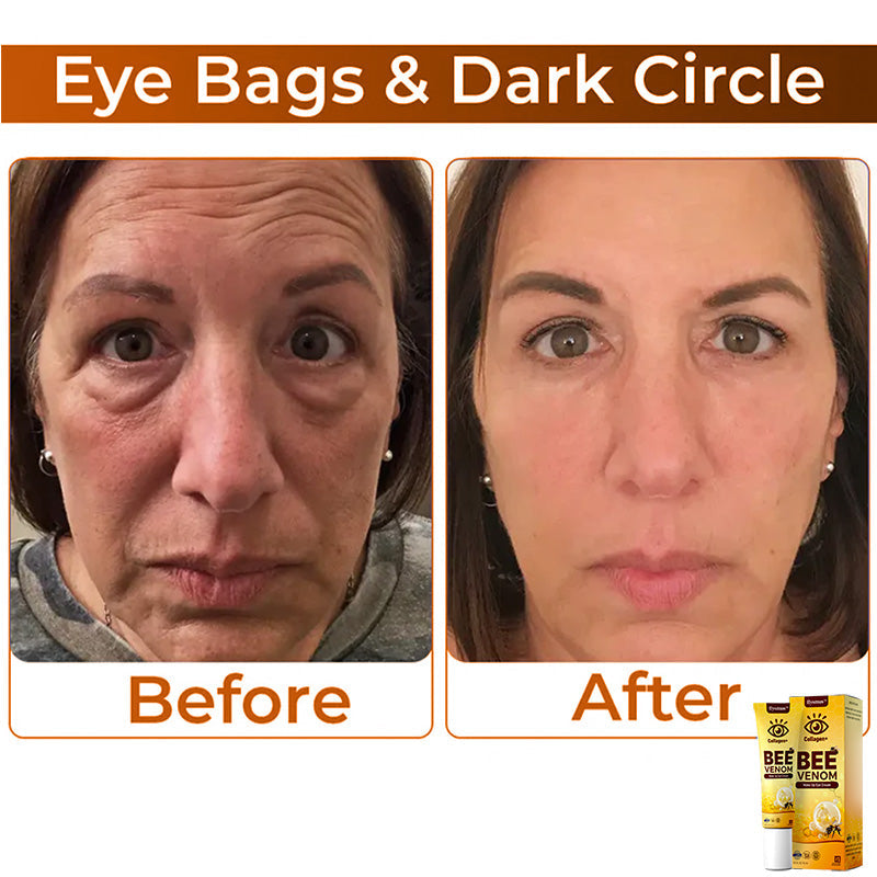 💖 flysmus™ Collagen+ Bee Venom Wake Up Eye Cream 🇦🇺