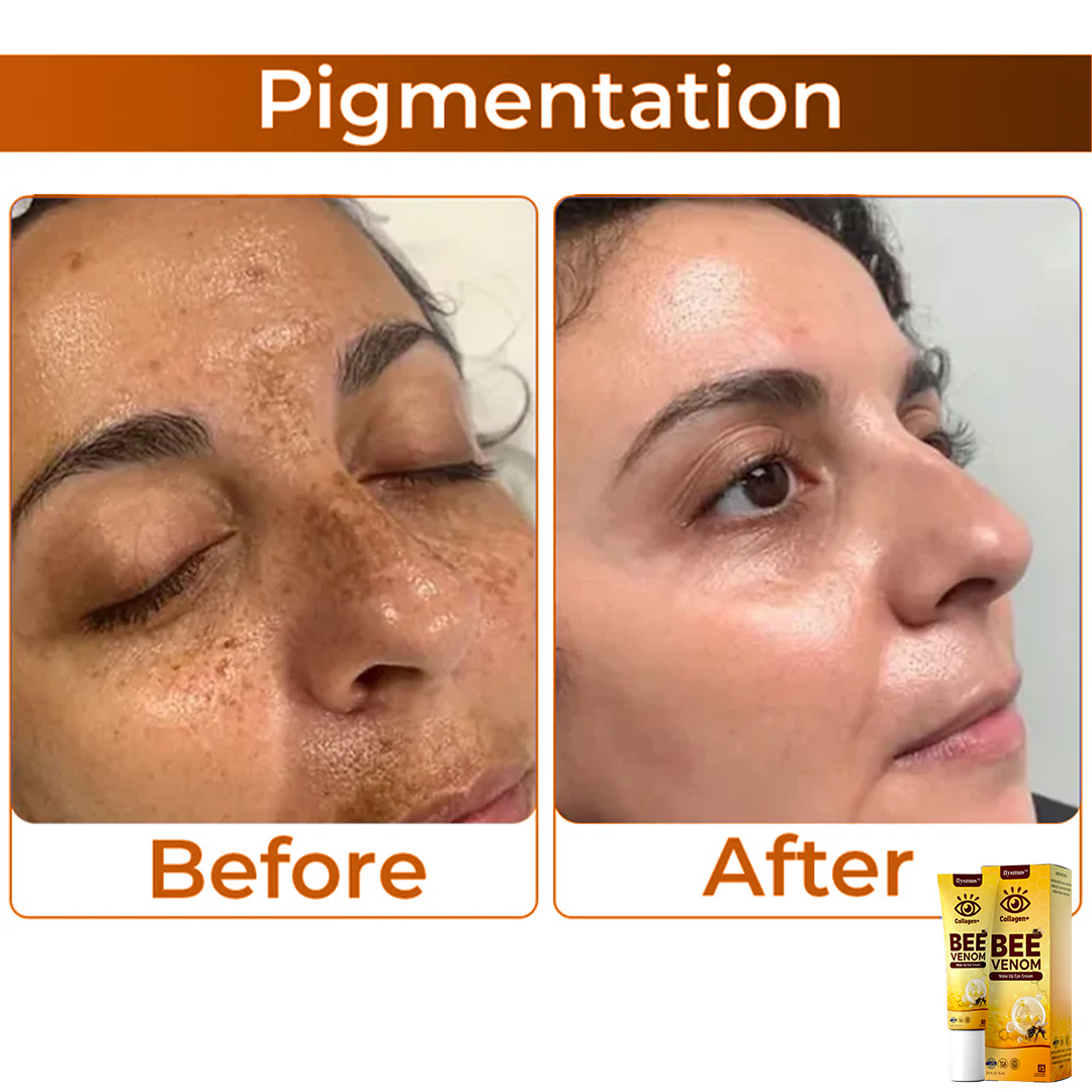 💖 flysmus™ Collagen+ Bee Venom Wake Up Eye Cream 🇦🇺
