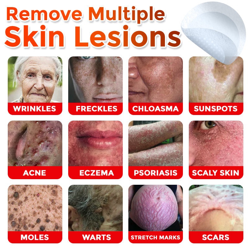 GFOUK® MicroNeedle Botanic Skin Tag Removal Patch 🇦🇺 Made in Australia