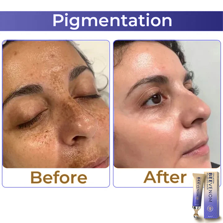 ✨ flysmus™ Collagen+ Bee Venom Roller Eye Cream 🇦🇺