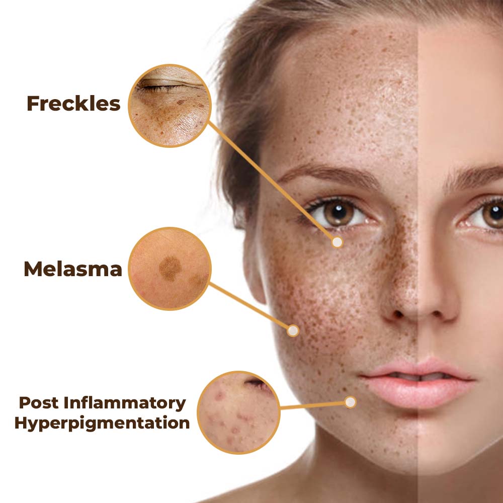 flysmus® PeptideLuxe Melanin Vanish Serum 🇦🇺 Made in Australia