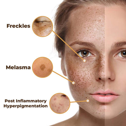 flysmus® PeptideLuxe Melanin Vanish Serum 🇦🇺 Made in Australia